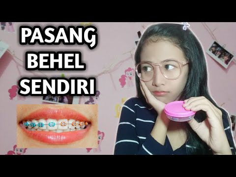 Keren! Pasang Behel Sendiri Di Rumah?😯 \ Cobain Behel Lepas Pasang Murah?? - Lhiasnm - Youtube