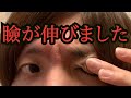 【注意喚起】アイテープの貼り過ぎで瞼が伸びました。【二重】