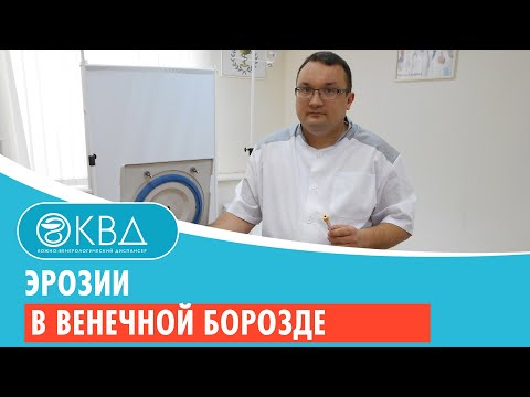 😟 Эрозии в венечной борозде. Клинический случай №761