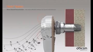 Discover the Ponto System