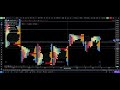 Trade Logic Daily 151225 | NIFTY BANKNIFTY | Market Profile | Volume Profile | Orderflow