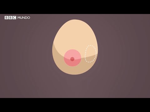 Video: Cómo identificar un bulto en un seno: 9 pasos (con imágenes)