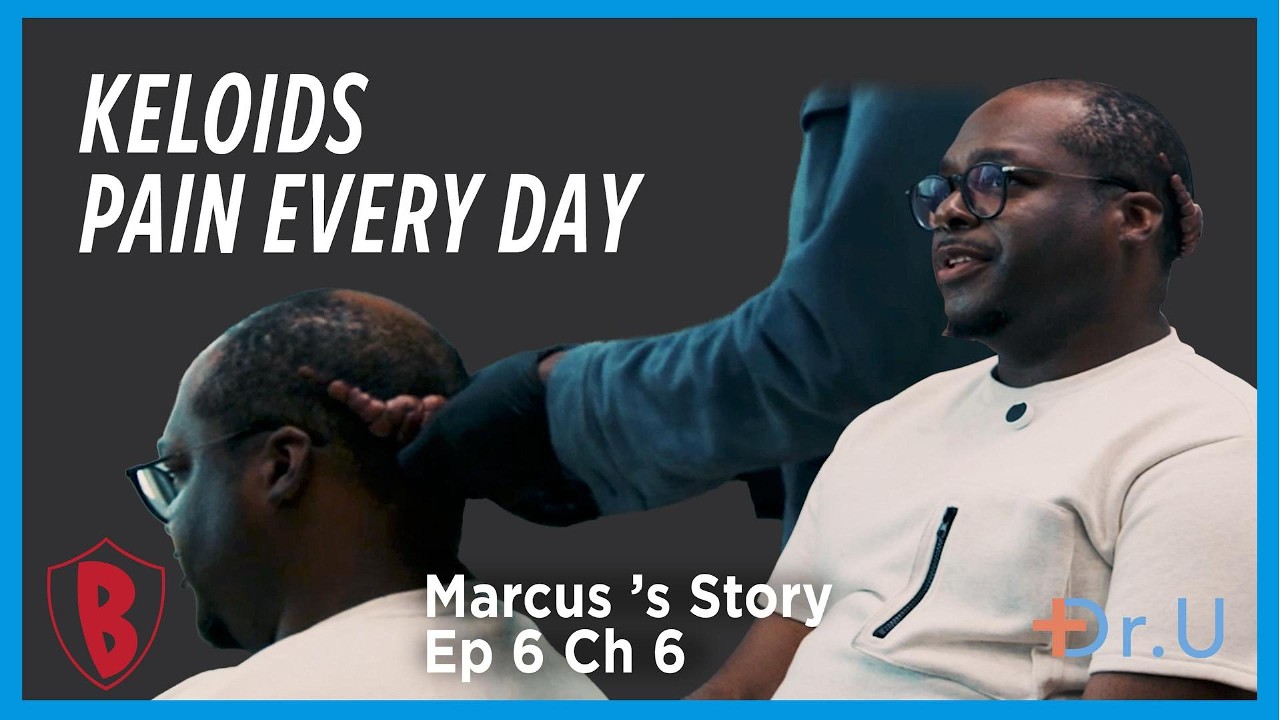 "It Hurts Every Day" | Living With a Painful Keloid