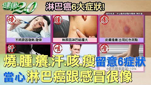 燒.腫.癢.汗.咳.瘦留意6大症狀 當心淋巴癌跟感冒很像  健康2.0 - 天天要聞