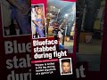 blueface stabbed during fight