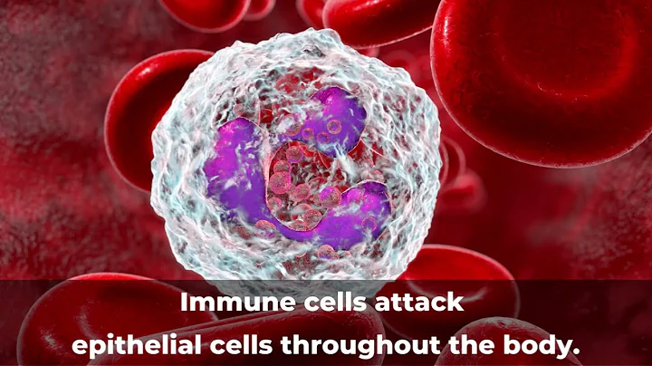Autoimmune Disease Awareness