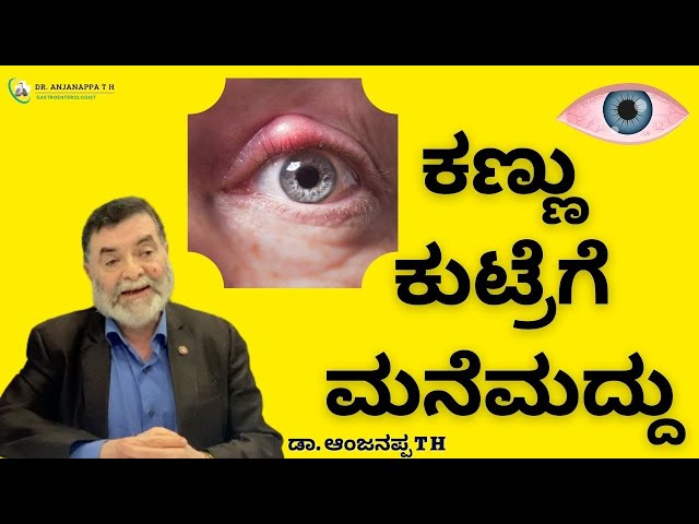 Home remedies for eye strain - Dr. Anjanappa TH class=