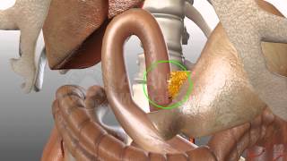 Pylorus-Preserving Pancreaticoduodenectomy