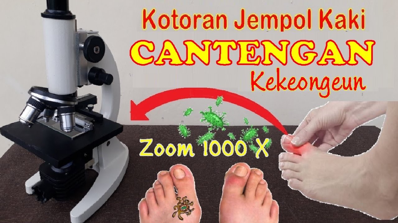 Jempol Kaki Cantengan Kekeongeun Bengkak dan Bau (Zoom 1000 X Mikroskop