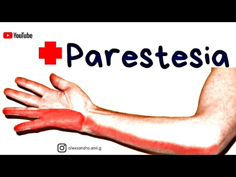 Vídeo: Paresia Das Extremidades - Paresia Das Pernas, Pés, Braços