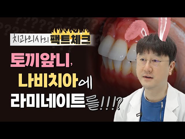 토끼이빨 나비치아 덧니 일주일만에 해결가능?? 급속부분교정 후 앞니라미네이트 알아보기