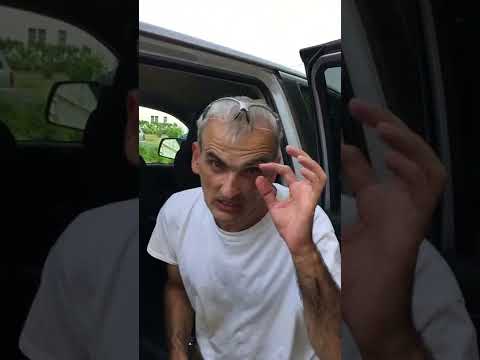 Как Избавиться от металлической стружки в глазу!