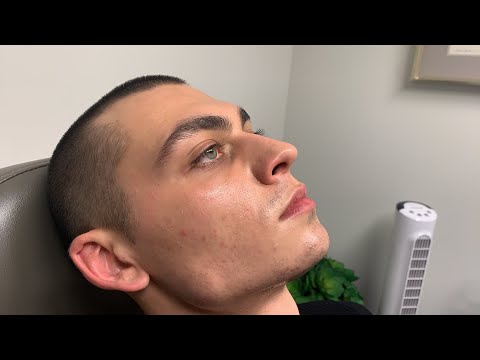 Sculpting the male jawline: Chin and neck contouring 101