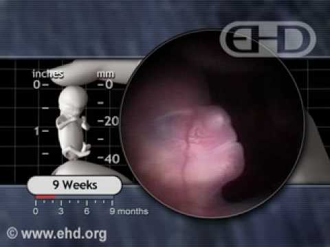 Video: Hvor stor er livmoren min ved 9 uker?