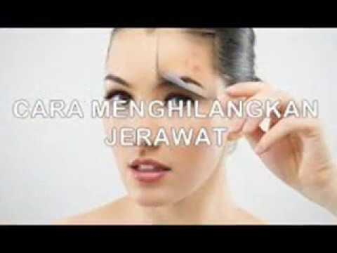 TIPS DAN CARA MENGOBATI JERAWAT#RESEP RAHASIA