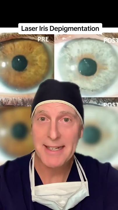 Safe to Have Eye Color Change??? Breaking it down for 3 procedures #eyecolorchange #eyecolor #shorts