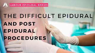 The difficult epidural and post epidural procedures | #anesthesiology #anesthesia #epidural