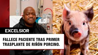 Muere paciente que recibió primer trasplante de riñón de cerdo genéticamente modificado