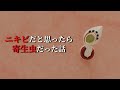 全然治らないニキビを検査したら寄生虫だった...