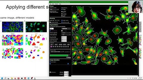 cellpose 2.0 tutorial: how to train your own cellular segmentation model