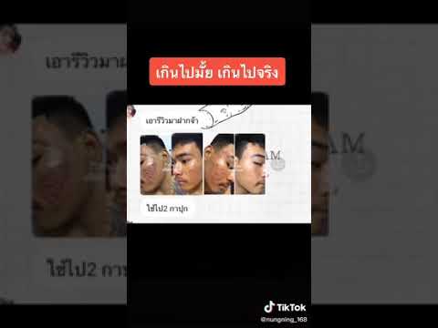ขมิ้นสด
