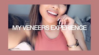 MY VENEERS EXPERIENCE