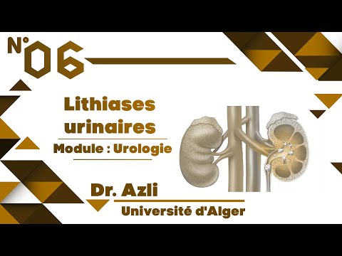 #Uro | 06. Lithiases urinaires (Dr. Azli)