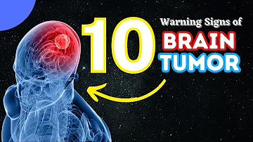 10 Warning Signs of Brain Tumor - Brain Tumor Symptoms