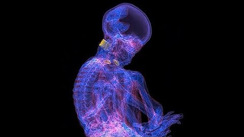 Virtual autopsy and scientific findings of adolescent Nazca tridactyl