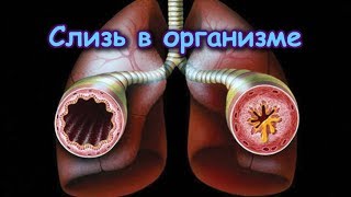СЛИЗЬ В ОРГАНИЗМЕ. Откуда берётся, чем опасна и как выводить? СЛИЗЬ В ОРГАНИЗМЕ. Откуда берётся, чем опасна и как выводить?