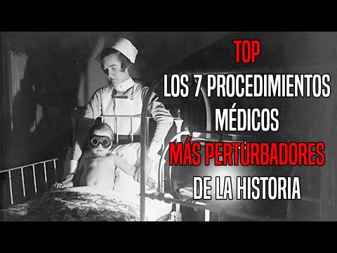 TOP: Los 7 Procedimientos Médicos Más Perturbadores De La Historia