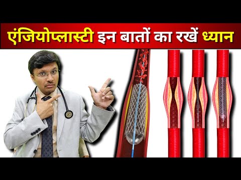 एंजियोप्लास्टी/स्टेंट के बाद:-समस्याएं/समाधान-PART1  AFTER ANGIOPLASTY-PROBLEMS AND SOLUTION  PART 1