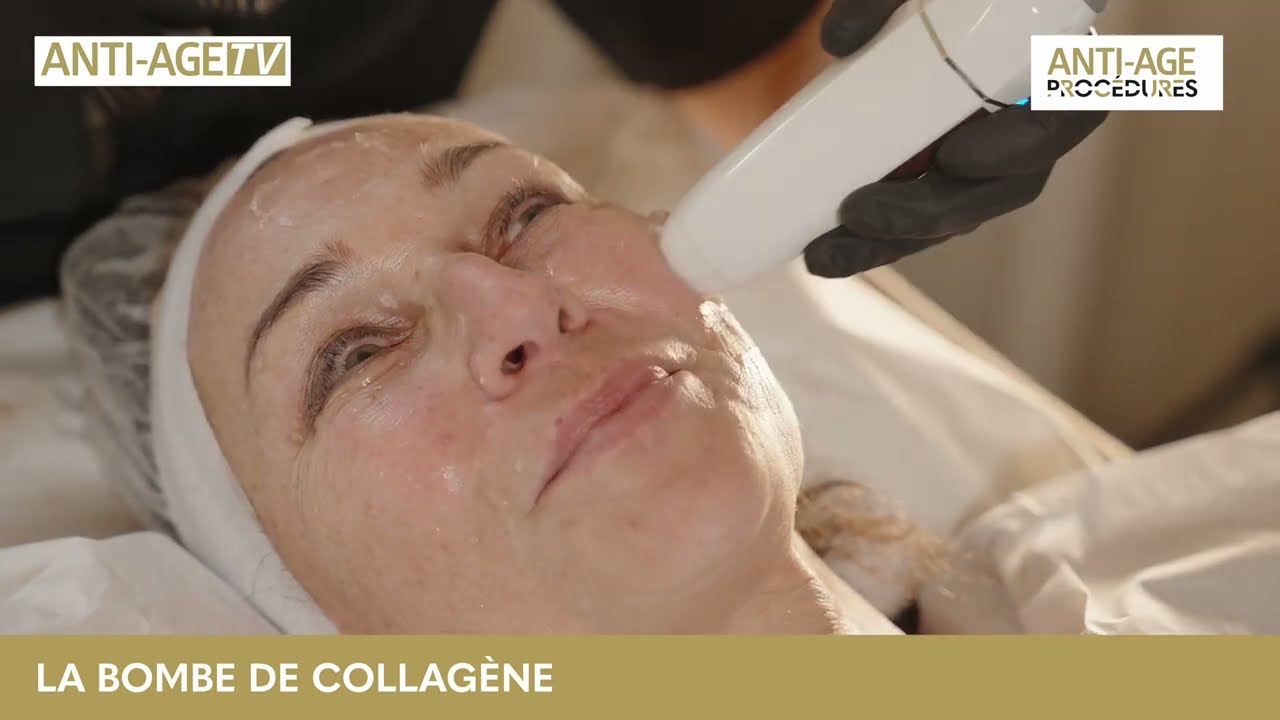 La Bombe de Collagène : La procédure expliquée par le Docteur Sandrine Sebban