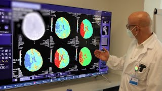 Schlaganfall - Neurologie / Stroke Unit