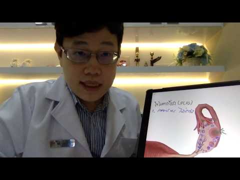 วีดีโอ: 4 วิธีในการตกไข่ด้วย Polycystic Ovary Syndrome (PCOS)