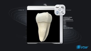 How to use Vdw Mtwo Rotary Files Dentbear.com