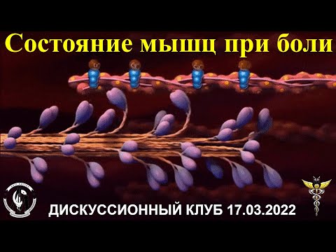 Дискуссионный клуб «Цервикокраниалгия: скелетно-мышечные причины боли. Состояние мышц при боли»