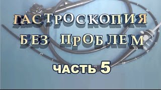 5 Часть Гастроскопия Без Проблем - Научитесь Проходить Без Боли И Неудобств