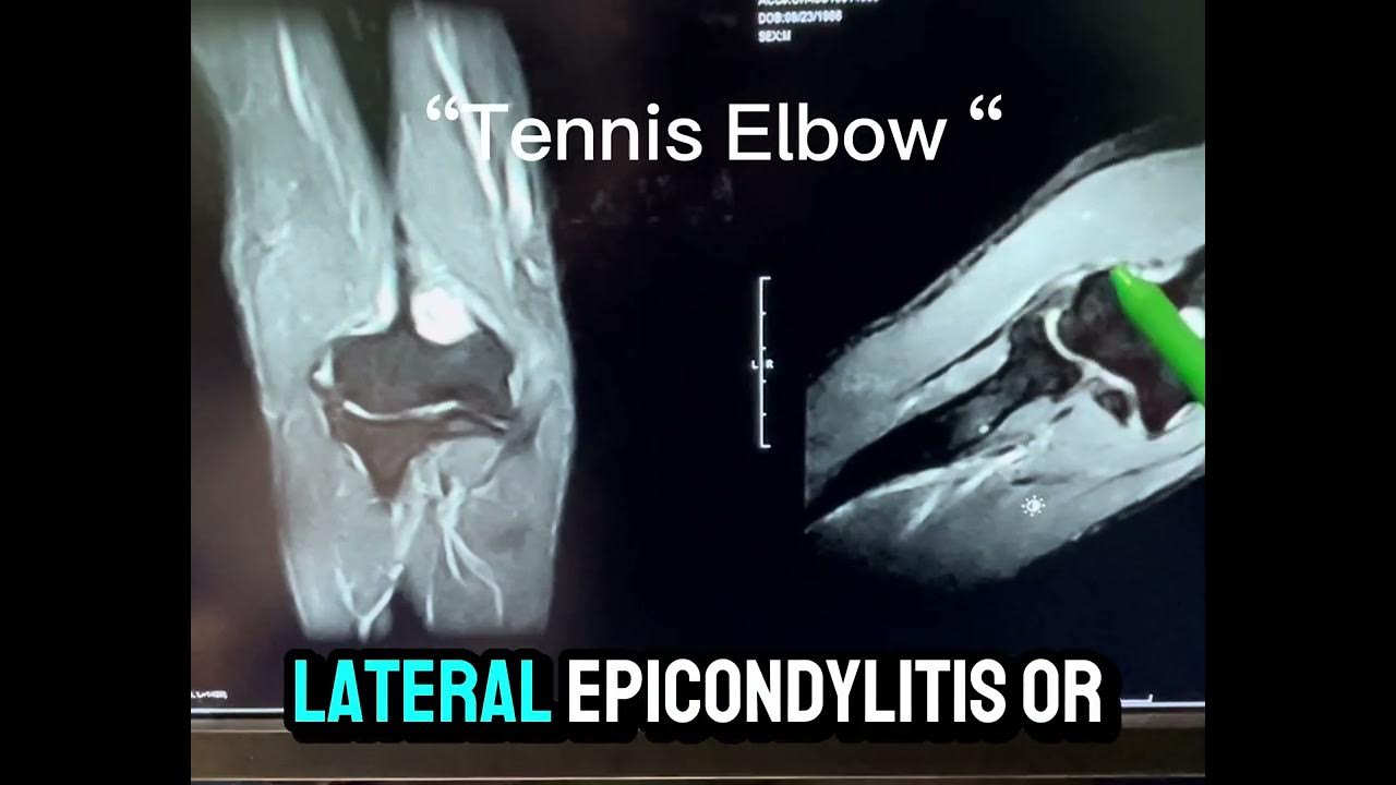 what-does-an-mri-show-what-are-the-benefits-of-open-mri-youtube