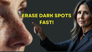 Sunscreen is Making Your Dark Spots WORSE? Here’s WHY!