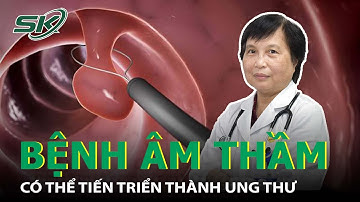 Polyp Dạ Dày - Căn Bệnh Âm Thầm Khó Phát Hiện Nhưng Lại Có Thể Gây Ung Thư I SKĐS