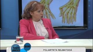 Poliartrita reumatoida - invitat: dr. Carmen Mihaela Dumitru(, 2015-02-18T20:04:51.000Z)