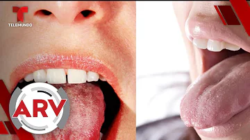 ¿La lengua blanca significa diabetes?