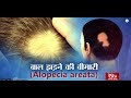 Ayushman Bhava : Alopecia Areata - Patchy Hair Loss | बाल झड़ने की बीमारी | Treatment & Cure