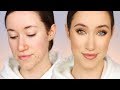 How I Cover My Acne (All Drugstore Makeup) 🙌🏼