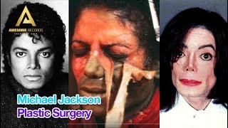 Michael Jackson Plastic Surgery Before and After Photos Slideshow