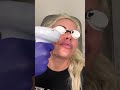 Ipl photo facial orange county   dr roham