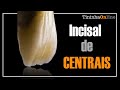 AULA #1 Incisal de Centrais