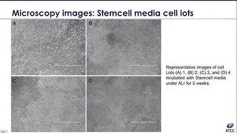 Evaluating the Differentiation Potential of Primary Airway Cells in 3-D Models