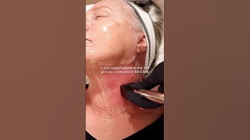 Sculpting Jawline And Cheekbones with This Treatment #skintightening